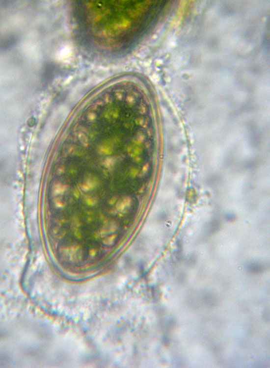 Alghe 3: Spirogyra sp